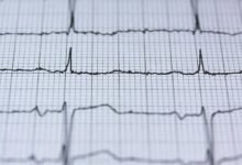 alpha pulse fusion technology